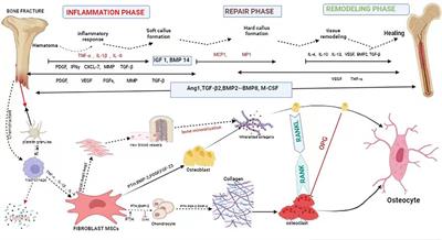 Advances in the role and mechanism of fibroblasts in fracture healing